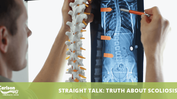 Straight Talk: The Truth About Scoliosis